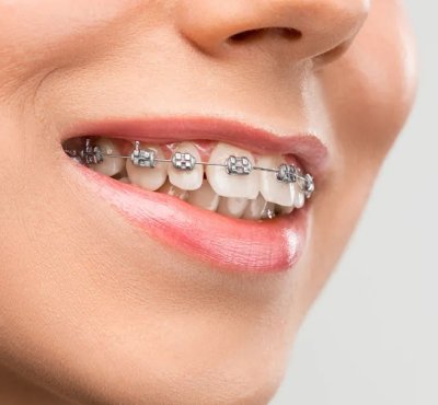 Dental Examination
